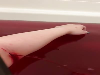 blood squirting from deep cut