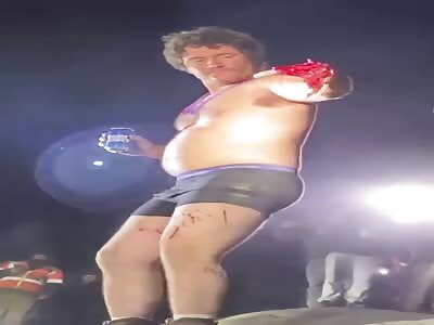 Drunk Genius Loses Fingers in Fireworks Failure (New Footage)