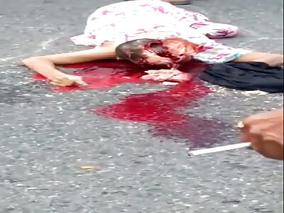old Vietnamese woman has her head exploded from an accident