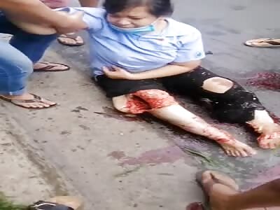 Woman has skinned legs on asphalt