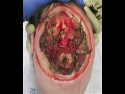 Random Death And Gore Pictures Compilation