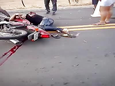Hd Aftermath Of A Nasty Motorcycle Accident 