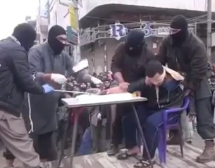 Man Having His Hand Chopped Off as Punishment For Stealing