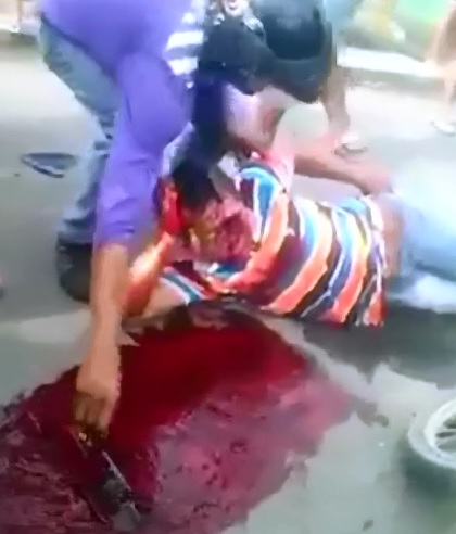 Man Missing his Face after Accident...Swipe Away the Blood 