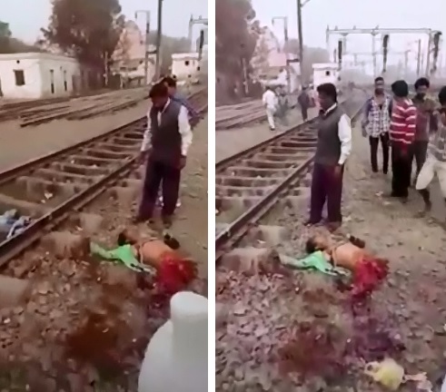 Now What??  Man Cut in Half by Train, Still Alive..Wants Help Somehow 