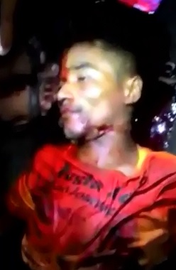 Man is a Bloody Mess after Multiple Stabbing...People continue to Film 