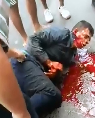 Thief Bleeding Out Profusely after his Victim Struck Back with a Bullet 