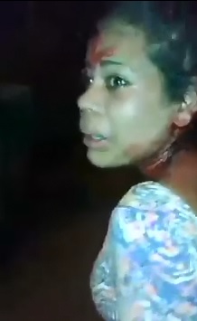Young Female was Beaten by Drug Dealers for Talking too Much..Bloodied and in Shock 