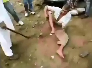 Man's Leg is Snapped like a Twig from Beating with Large Stick 