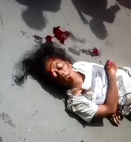 Woman is Crushed and left Unrecognizable but Still Alive in the Road