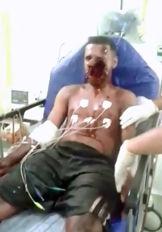 Thug sits in Emergency Room with Face Destroyed by Rifle Shot 