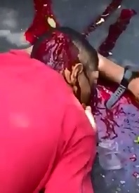 Dying Man Gargles in his Own Blood for Final Minutes of Life 