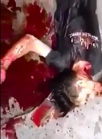 Follow the Blood..Kid lies in the Street with his Throat Open 