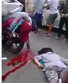 Unique, Bizarre and Gruesome Aftermath Footage of a Rear Ending Bike Accident 