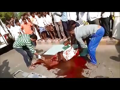 Still Alive!? Bloody Mess Man in horrible agony being removed from accident scene