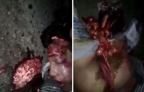 Man with head open and another with intestines commig out his ass