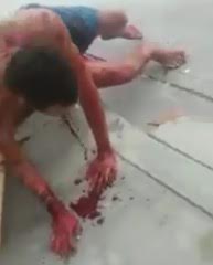 Man Bleeding profusely by the mouth and nose after being Stabbed