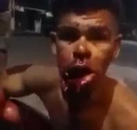Man trying to Speak after being Shot in the Mouth..Doesn't go Well 
