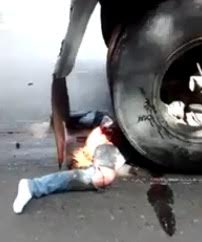 Another Poor Guy Crushed under the Truck Wheel with Legs Spread Wide Open 
