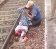 Guy tries to Comfort a Man who lost his leg in train accident