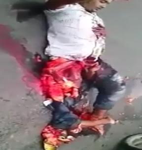 Horrible: Man with Penis and Legs Destroyed after being Dragged by truck