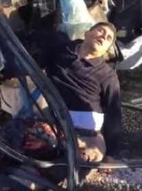 Bus driver w/ legs fucked still agonizing after crash