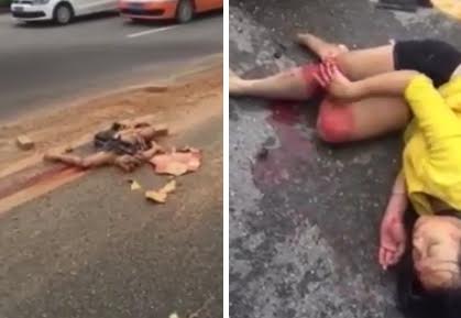 Boyfriend crushed and girl keeps touching her exposed bone