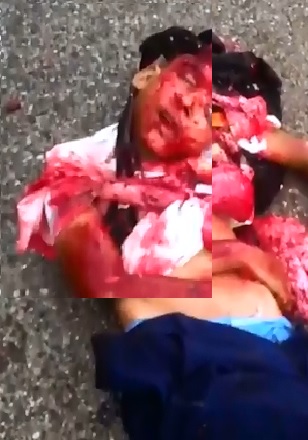 Girl with Deformed Face after Fatal Accident..Cameraman First on Scene 
