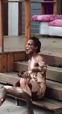 Brutal Painful Aftermath of Man who tried to Steal Copper Wire 