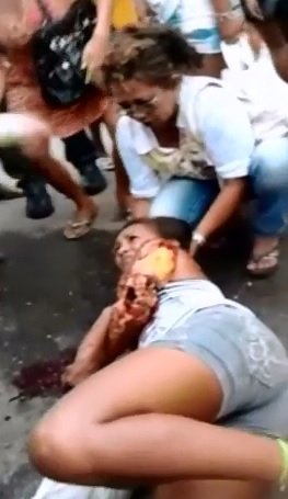 Woman Sitting Sideways with Her Arm Ripped Off 
