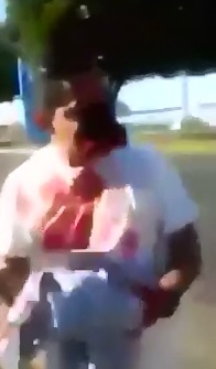 Man tries Conversation with his Face Ripped Off 