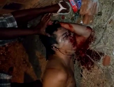 Final Gushing Blood Gurgling Moments After Accident ... Graphic video