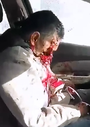 Short Video of Man Executed via Shotgun to the Face 