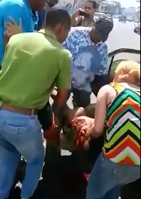 Shock Gore:  Woman Carries the Leg of her Friend after its Ripped Off during Accident 