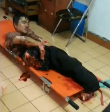 Man still Alive inside Police Station after Suicide Fail...Arm and leg Ripped Off 
