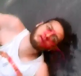 Hard to Watch Scene of Man Spitting up Blood and in Shock Dying 