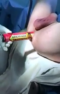 TALL Spray Can Removed from a Mans Ass 