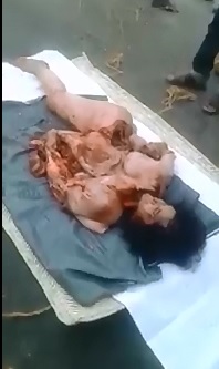 Fully Nude Woman who was Dismembered in Accident 