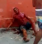 Dude Bleeds Out on the Street