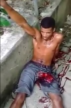 Thug Loses his Penis After Being Shot by Police