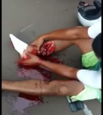 Kid Trying Desperately to Reattach his Foot after Being Chased by Police