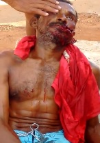 Longer Version of Man Face Hacked with Machete Blows Agonizing