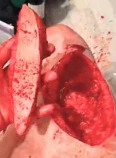 Sick Fucker Cuts out a Pound of Flesh and Sends to Obama