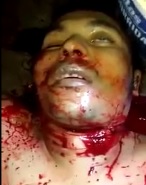 Man Dying with Open Slit Throat 