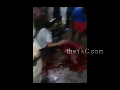 Bloody Mess After Being Shot