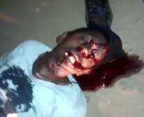 Guy executed with shots in the head lost some teeth