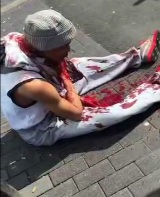 Homeless Dude Bleeds Endlessly 
