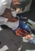Woman Goes Into Despair Seeing her Leg and Foot Ripped Apart