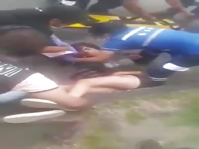 Cute Girl Wearing Small Black Shorts Being Revived After Accident