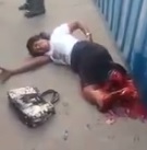 Woman Agonizes After Legs are Crushed and Ripped Apart by Truck